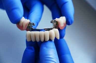 Crowns, Dentures & Bridges