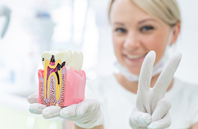 Root Canal