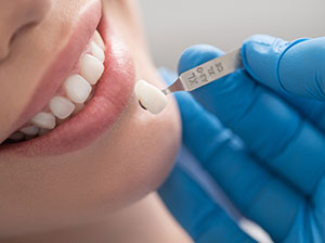 Same Day Crowns at Murias Dental