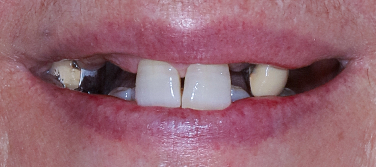Before Image